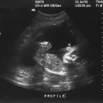 Pregnancy and birth superstitions in Azerbaijan